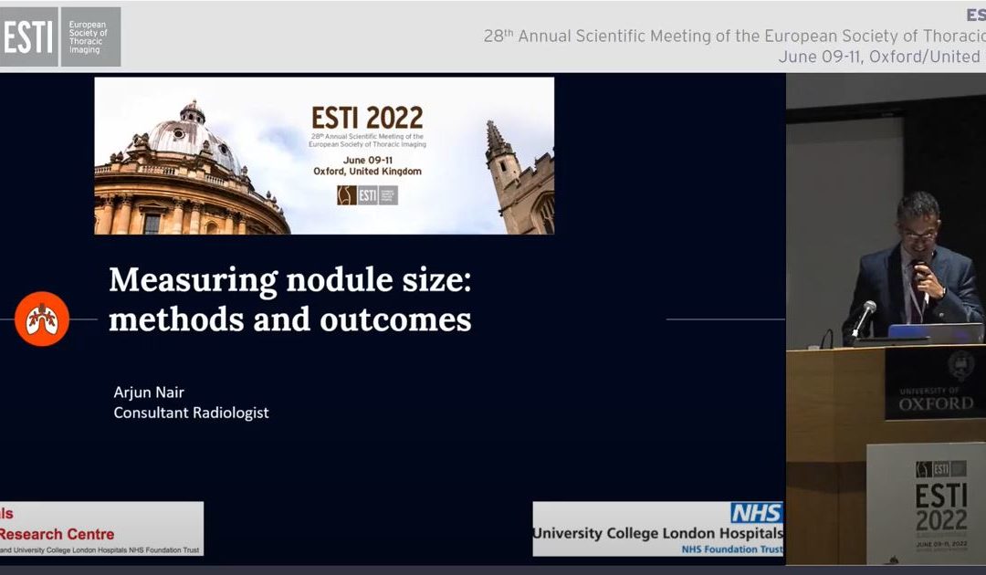 Measuring nodule size – Methods and outcomes