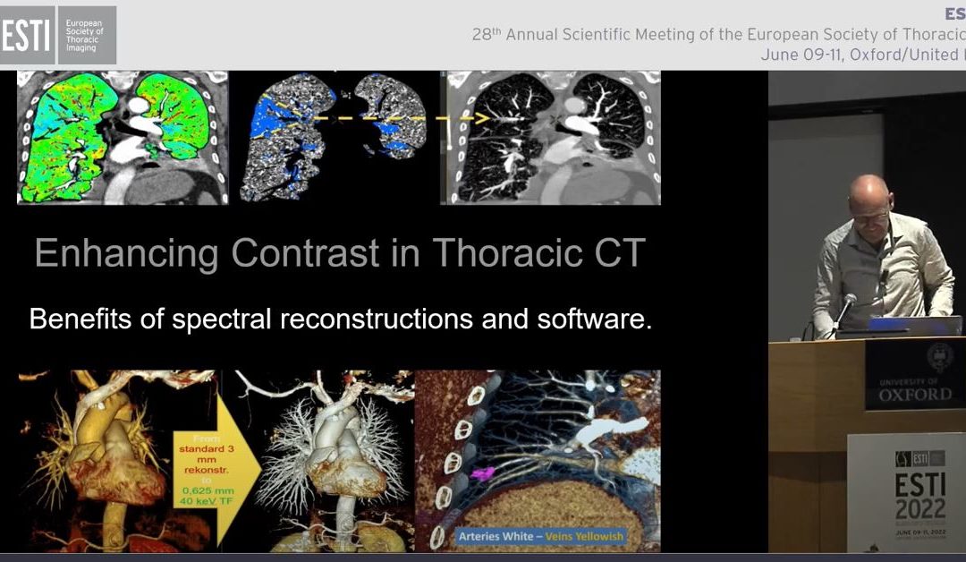 Enhancing Contrast in Thoracic CT – Benefits of spectral reconstructions and software
