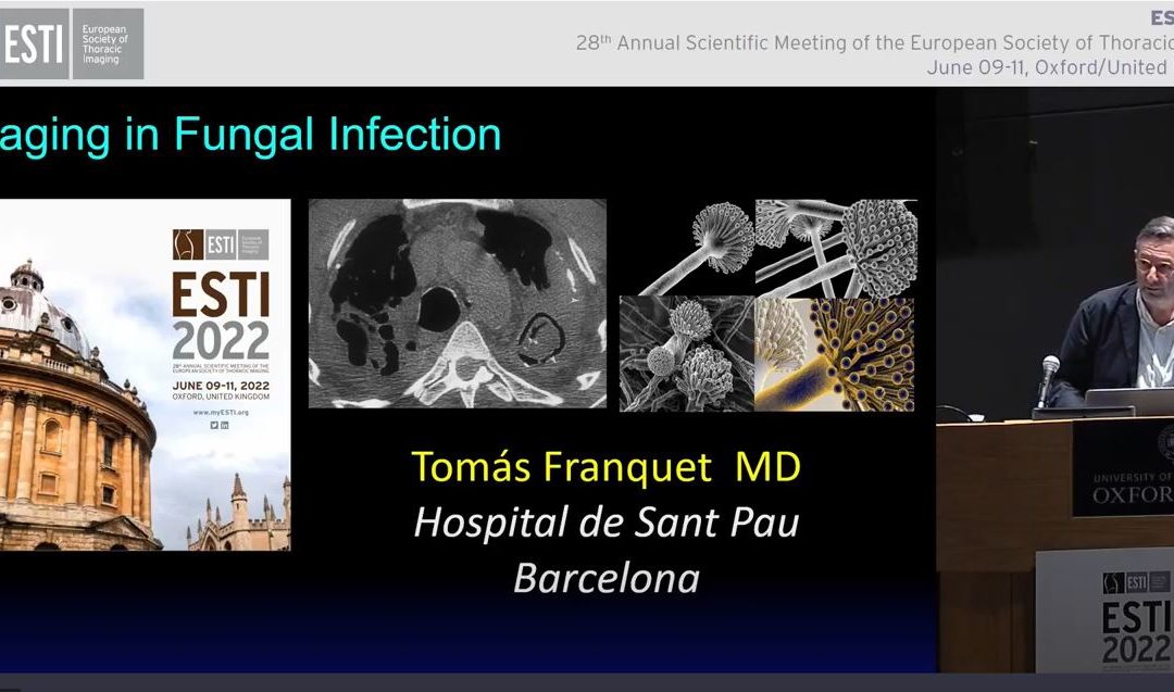 Imaging in fungal infection