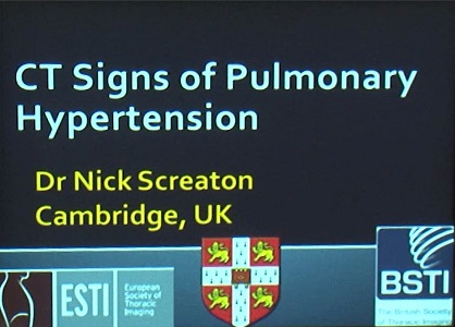 CT Signs of Pulmonary Hypertension