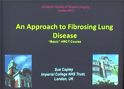 An Approach to Fibrosing Lung Disease