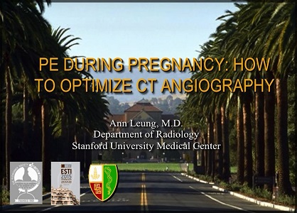 PE during pregnancy: How to optimize CT angiography?