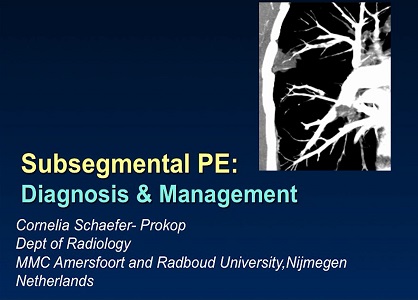 Subsegmental PE: Diagnosis and management