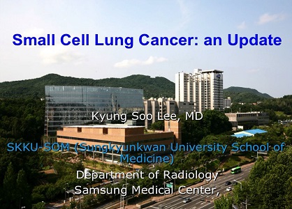 Small cell lung cancer: An update