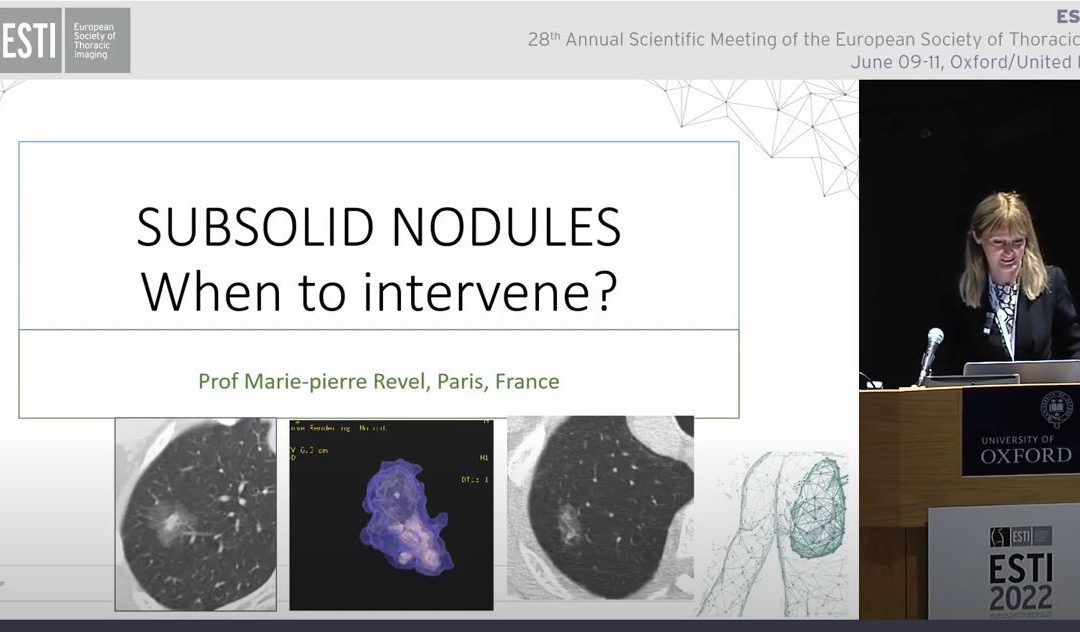 Subsolid nodules – When to intervene?