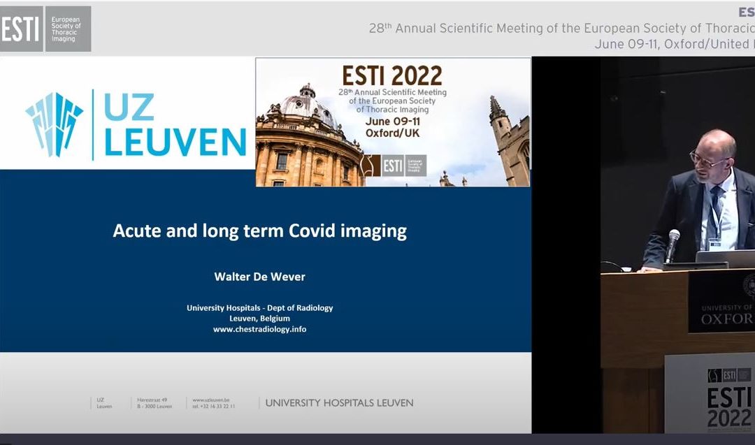 Acute and long term Covid imaging