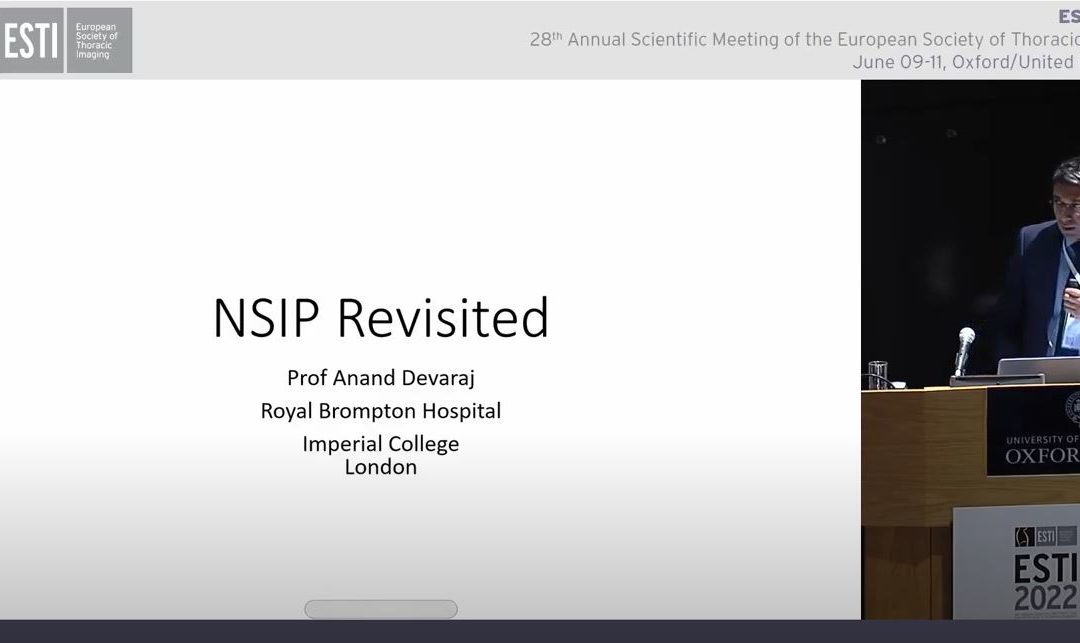 NSIP revisited