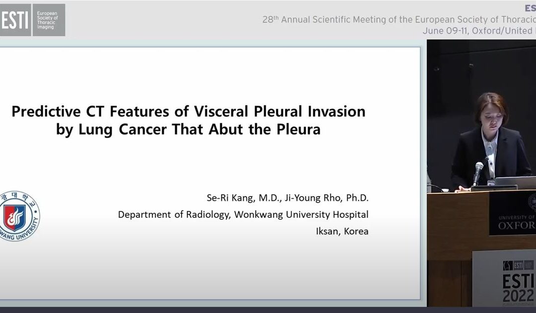 Predictive CT Features of Visceral Pleural Invasion by Lung Cancer That Abut the Pleura