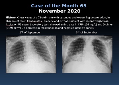 Case 65