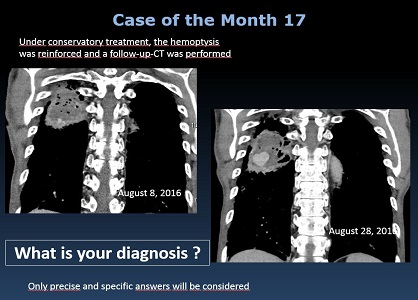 Case 17