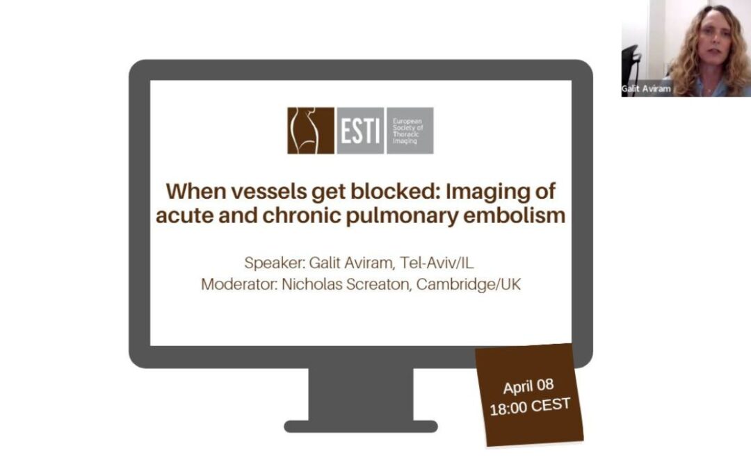 Webinar 02_2024